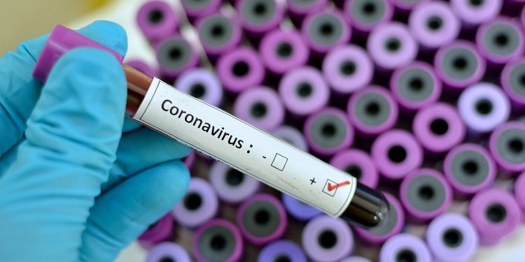Cardinal tips API supply chain to weather coronavirus impact