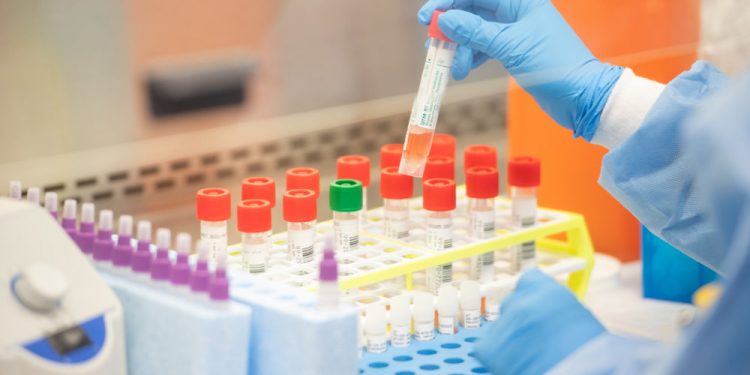 Akufo-Addo announces procurement of 50,000 coronavirus test kits