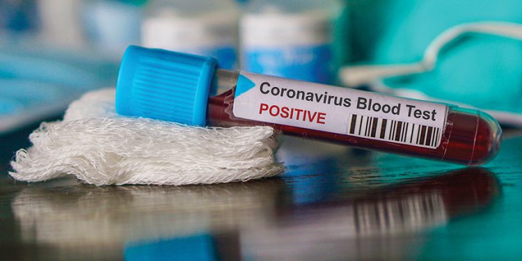 Lawrence County sees first coronavirus case – Daily Leader