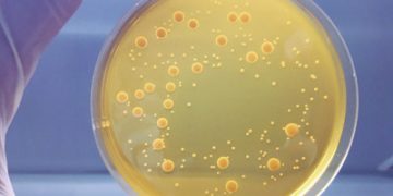 Global Agar Market Opportunities & Strategic Assessment 2020-2024